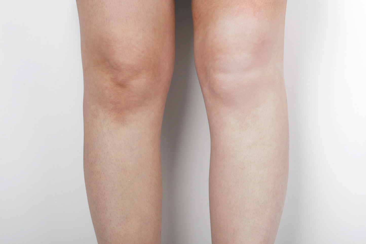 Éclat du teint Body Brightener 100ml (PRO)