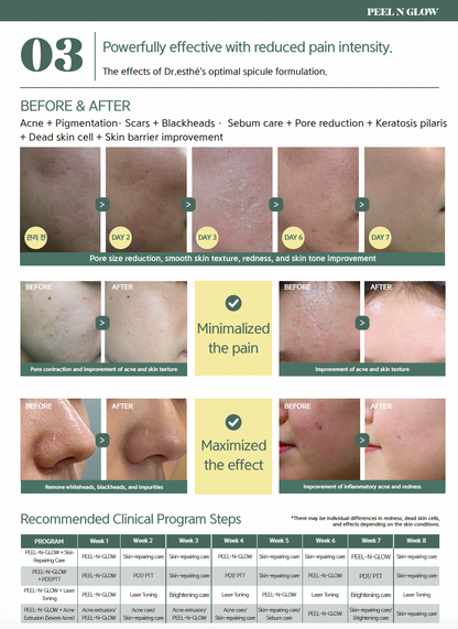 Dr. Esthe Peel N Glow Treatment (One application)